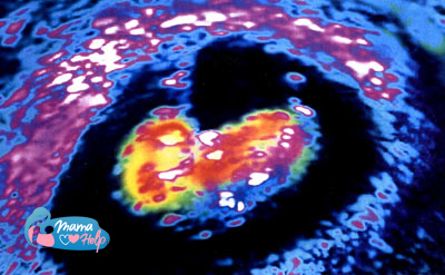 внутриутробное развитие